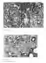 Fig. 06 - Detection, screening, and diagnosis of HPV-associated cancers