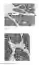 Fig. 12 - Detection, screening, and diagnosis of HPV-associated cancers
