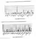 Fig. 22 - Nucleotide and amino acid sequences, and assays and methods of use thereof for diagnosis