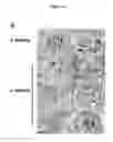 Fig. 02 - METHODS FOR DETECTING AND TREATING KIDNEY DISEASE