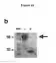 Fig. 03 - METHODS FOR DETECTING AND TREATING KIDNEY DISEASE