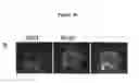 Fig. 10 - METHODS FOR DETECTING AND TREATING KIDNEY DISEASE