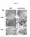 Fig. 15 - METHODS FOR DETECTING AND TREATING KIDNEY DISEASE