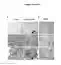 Fig. 18 - METHODS FOR DETECTING AND TREATING KIDNEY DISEASE
