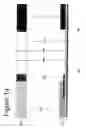 Fig. 02 - RAPID IMMUNOCHROMATOGRAPHIC DETECTION BY AMPLIFICATION OF THE COLLOIDAL GOLD SIGNAL