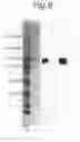 Fig. 07 - ANTIBODY SPECIFIC TO INTACT HUMAN AUTOTAXIN, METHOD OF SCREENING THE SAME AND METHOD AND REAGENT FOR EXAMINING MALIGNANT LYMPHOMA BY ASSAYING AUTOTAXIN