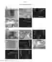 Fig. 14 - MULTIPOTENT/PLURIPOTENT CELLS AND METHODS