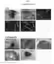 Fig. 15 - MULTIPOTENT/PLURIPOTENT CELLS AND METHODS