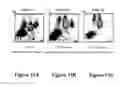 Fig. 32 - HIGH SENSITIVITY PARAMETERS FOR THE DETECTION OF VITAMIN B12 AND/OR FOLATE DEFICIENCIES AND METHODS OF USE