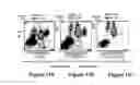 Fig. 33 - HIGH SENSITIVITY PARAMETERS FOR THE DETECTION OF VITAMIN B12 AND/OR FOLATE DEFICIENCIES AND METHODS OF USE