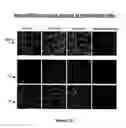 Fig. 32 - RECOMBINANT PROTEINS AND VIRUS LIKE PARTICLES COMPRISING L AND S POLYPEPTIDES OF AVIAN HEPADNAVIRIDAE AND METHODS, NUCLEIC ACID CONSTRUCTS, VECTORS AND HOST CELLS FOR PRODUCING SAME