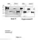Fig. 49 - RECOMBINANT PROTEINS AND VIRUS LIKE PARTICLES COMPRISING L AND S POLYPEPTIDES OF AVIAN HEPADNAVIRIDAE AND METHODS, NUCLEIC ACID CONSTRUCTS, VECTORS AND HOST CELLS FOR PRODUCING SAME