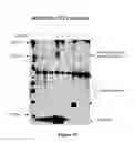 Fig. 61 - RECOMBINANT PROTEINS AND VIRUS LIKE PARTICLES COMPRISING L AND S POLYPEPTIDES OF AVIAN HEPADNAVIRIDAE AND METHODS, NUCLEIC ACID CONSTRUCTS, VECTORS AND HOST CELLS FOR PRODUCING SAME