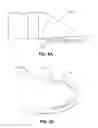 Fig. 09 - Retractor cannula system for accessing and visualizing spine and related methods
