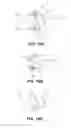 Fig. 12 - Retractor cannula system for accessing and visualizing spine and related methods