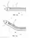 Fig. 13 - Retractor cannula system for accessing and visualizing spine and related methods