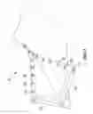 Fig. 05 - ARM SLING AND DECORATIVE SLING JACKET