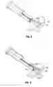 Fig. 05 - Method and apparatus for meniscal repair