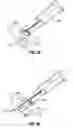 Fig. 12 - Method and apparatus for meniscal repair
