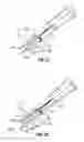 Fig. 13 - Method and apparatus for meniscal repair