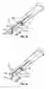 Fig. 14 - Method and apparatus for meniscal repair