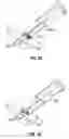 Fig. 17 - Method and apparatus for meniscal repair
