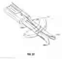 Fig. 24 - Method and apparatus for meniscal repair