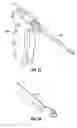 Fig. 41 - Method and apparatus for meniscal repair