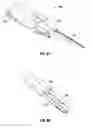Fig. 48 - Method and apparatus for meniscal repair
