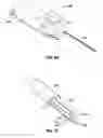 Fig. 49 - Method and apparatus for meniscal repair