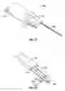 Fig. 50 - Method and apparatus for meniscal repair
