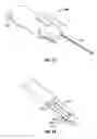 Fig. 51 - Method and apparatus for meniscal repair