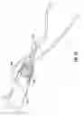 Fig. 58 - Method and apparatus for meniscal repair