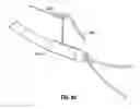 Fig. 60 - Method and apparatus for meniscal repair