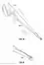 Fig. 62 - Method and apparatus for meniscal repair