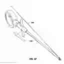 Fig. 63 - Method and apparatus for meniscal repair