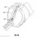 Fig. 69 - Method and apparatus for meniscal repair