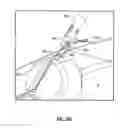 Fig. 77 - Method and apparatus for meniscal repair