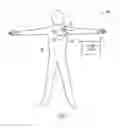 Fig. 02 - Method and apparatus for delivering chronic and post-ischemia cardiac therapies