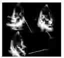 Fig. 01 - METHODS AND APPARATUS FOR COMBINED 4D PRESENTATION OF QUANTITATIVE REGIONAL PARAMETERS ON SURFACE RENDERING