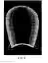 Fig. 06 - METHODS AND APPARATUS FOR COMBINED 4D PRESENTATION OF QUANTITATIVE REGIONAL PARAMETERS ON SURFACE RENDERING
