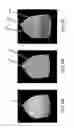 Fig. 09 - METHODS AND APPARATUS FOR COMBINED 4D PRESENTATION OF QUANTITATIVE REGIONAL PARAMETERS ON SURFACE RENDERING
