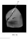 Fig. 11 - METHODS AND APPARATUS FOR COMBINED 4D PRESENTATION OF QUANTITATIVE REGIONAL PARAMETERS ON SURFACE RENDERING