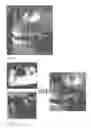 Fig. 02 - Image registration