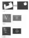 Fig. 03 - Image registration