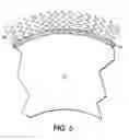 Fig. 04 - Fuser member coating having self-releasing fluoropolymer-fluorocarbon layer