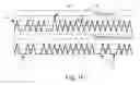 Fig. 03 - Non-invasive fetal genetic screening by digital analysis
