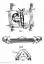 Fig. 02 - Head Suspension Device Vertebral Decompression Method with a Teeth Guard