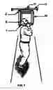 Fig. 06 - Head Suspension Device Vertebral Decompression Method with a Teeth Guard