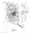 Fig. 02 - Methods for selectively heating tissue